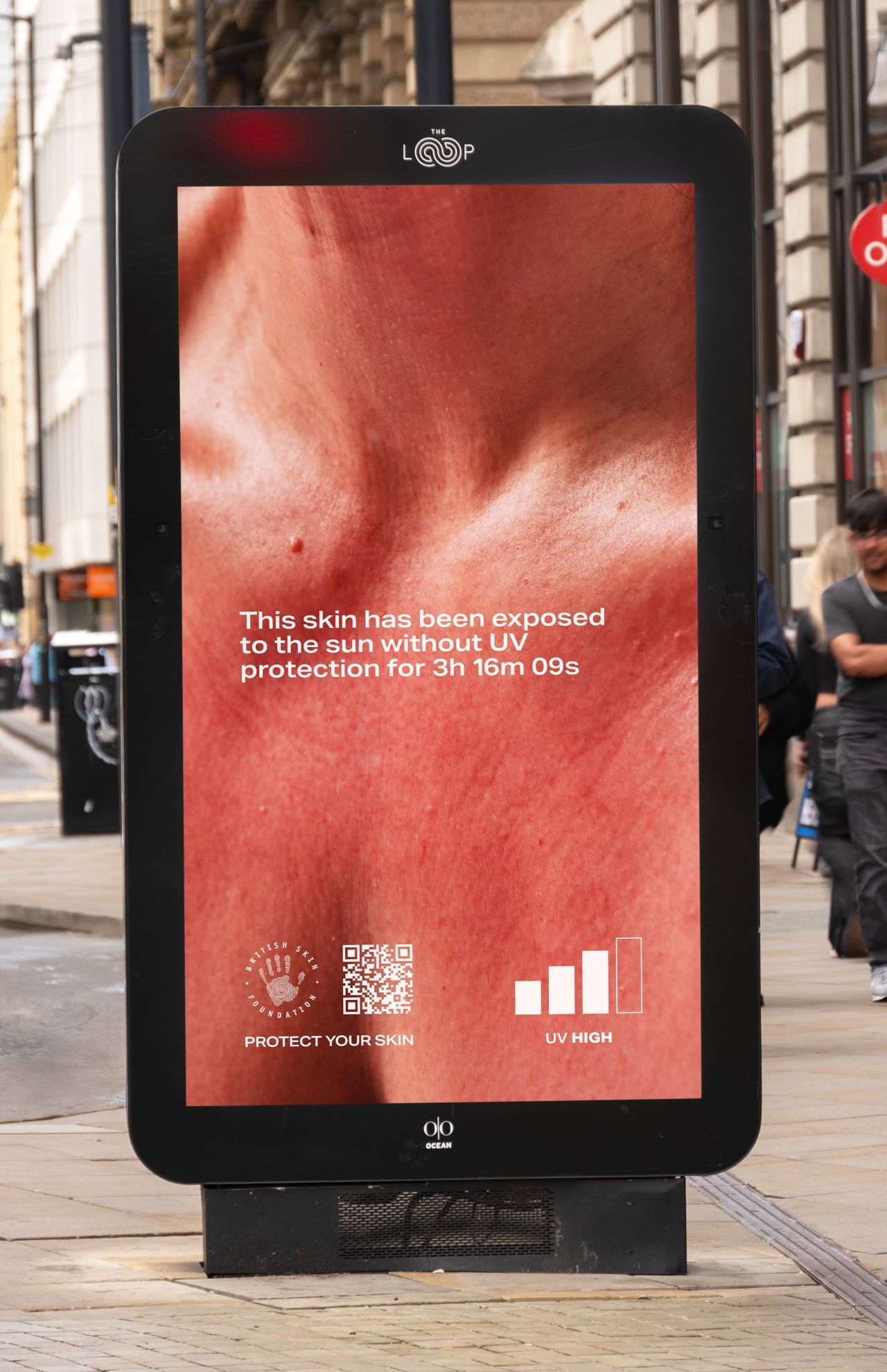 ‘Burnable Billboards’ reveal risks of sun exposure in real time ...