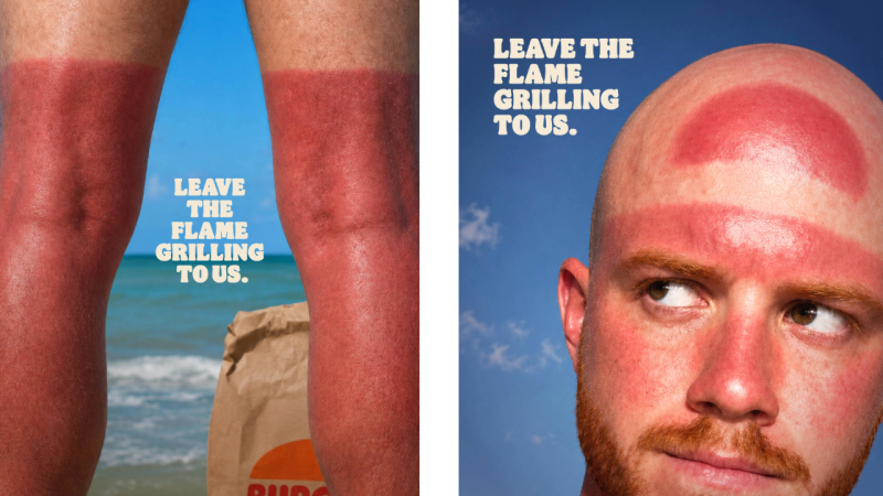 Burger King turns summer sunburn into flame-grilled advertising
